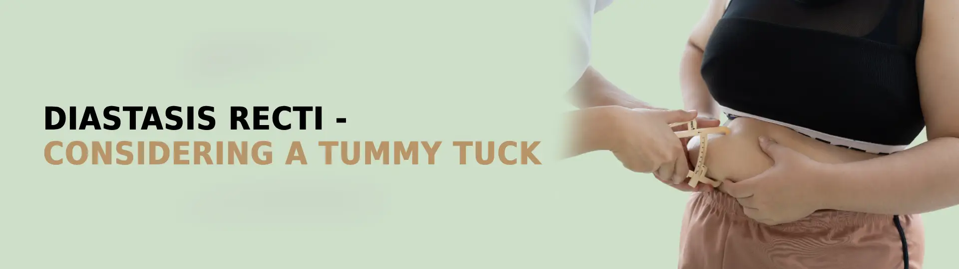 Diastasis Recti - Considering a Tummy Tuck?